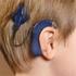 Dubbelzijdige cochleaire implantatie bij kinderen: de primaire voordelen